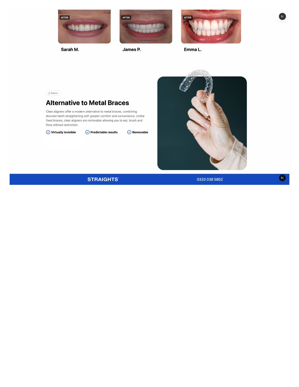 Clear aligner before and after results