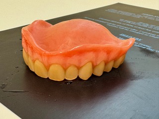 Angled side view of a custom Swiss denture showing natural tooth alignment, precise fit and comfortable denture design.