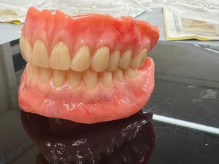 Side view of upper and lower Swiss dentures showing natural tooth alignment, stable occlusion and improved chewing function.