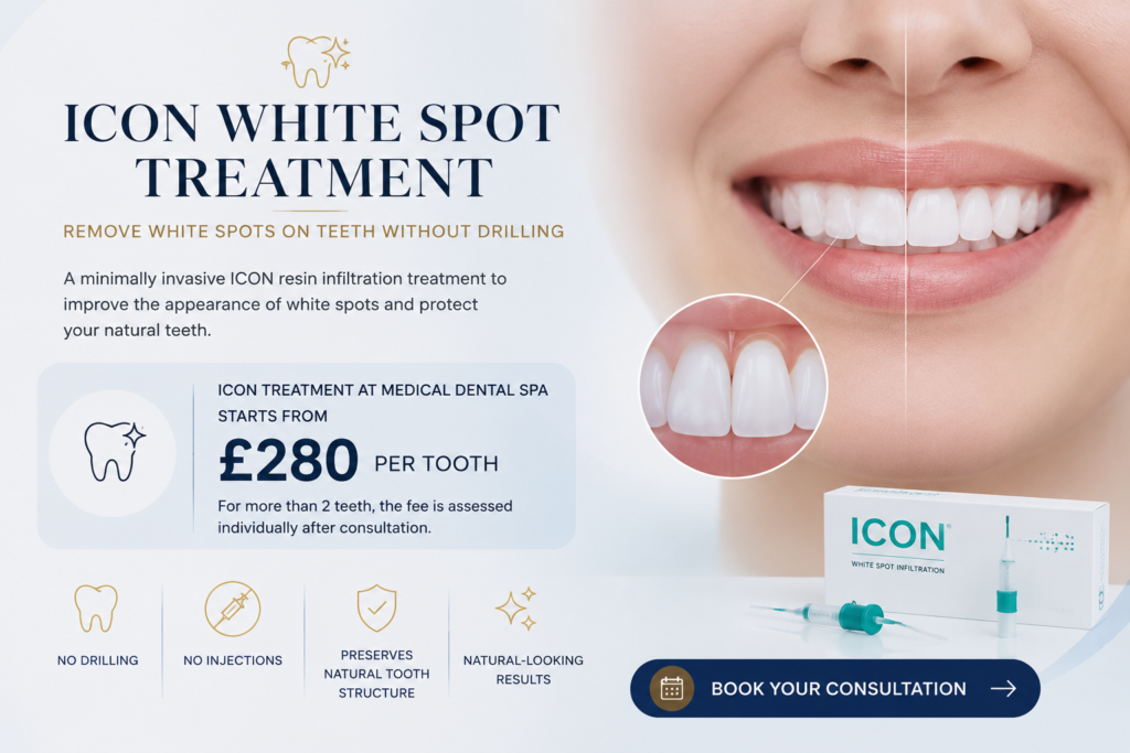ICON White Spot Treatment at Medical Dental Spa in West Hampstead showing minimally invasive resin infiltration to remove white spots on teeth without drilling, from £280 per tooth.
