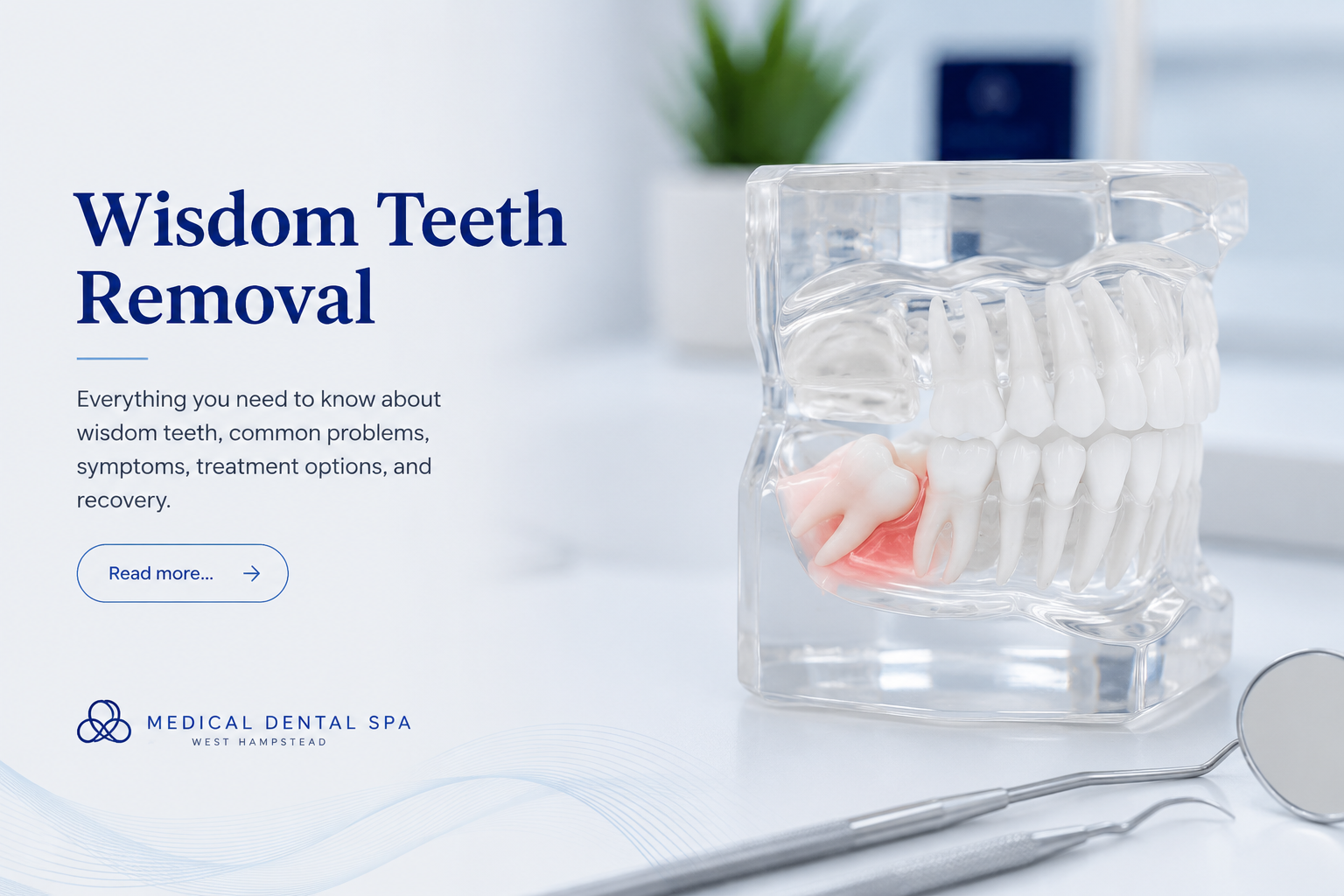 Dental model showing an impacted wisdom tooth used to explain wisdom teeth removal treatment at Medical Dental Spa West Hampstead.